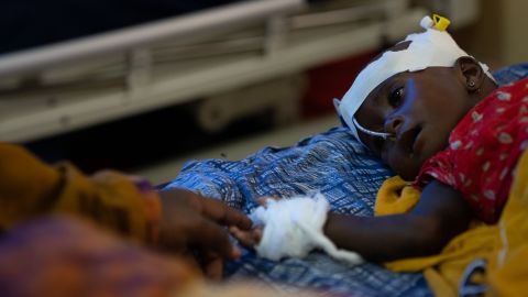 Fatima Abdullah cerca di toccare la figlia di 8 mesi Abdi, che a luglio è stata ricoverata in ospedale per grave malnutrizione in Somalia.